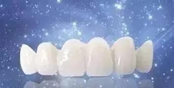 牙齿美容全瓷牙的优缺点有哪些,牙齿美容烤瓷牙费用