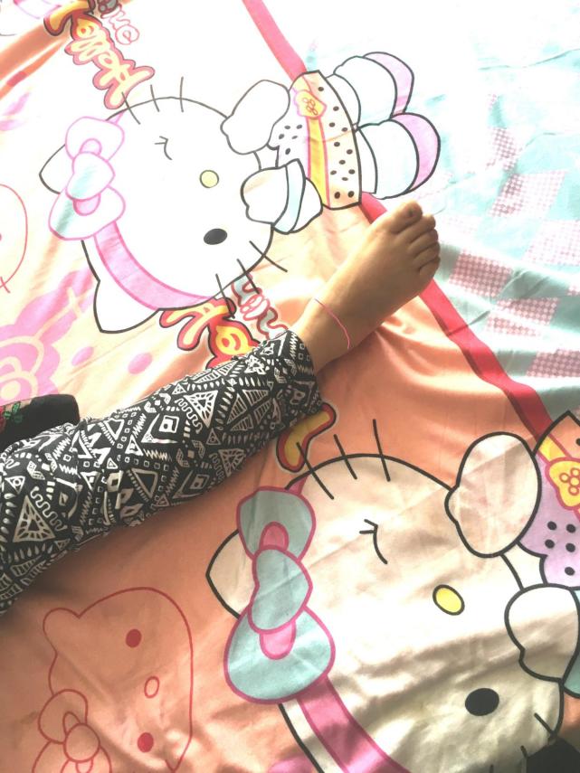 脚腕扭伤几年了脚腕还疼怎么运动,扭伤脚腕怎么处理