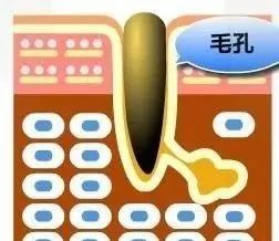 毛孔粗大原因及如何改善,突然毛孔粗大是什么原因