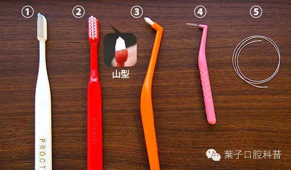 牙套人在学校怎么刷牙,如何戴着牙套正确刷牙