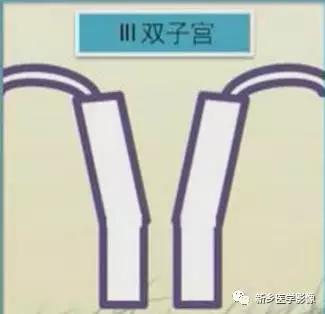 子宫发育异常，应想到的6大类常见畸形