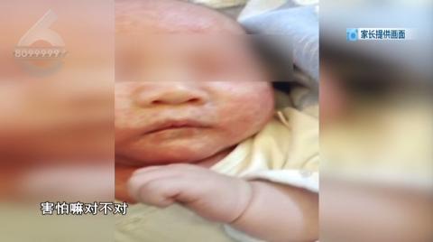 婴儿耳朵和嘴巴一圈红肿,婴儿吃药后嘴巴边上都红肿