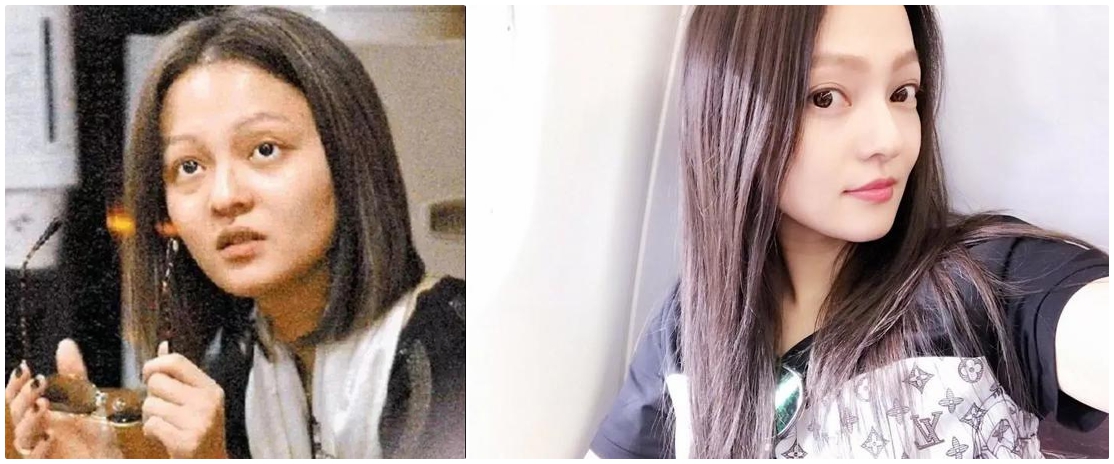 张韶涵澳洲玲珑面膜,张韶涵护肤敏感肌