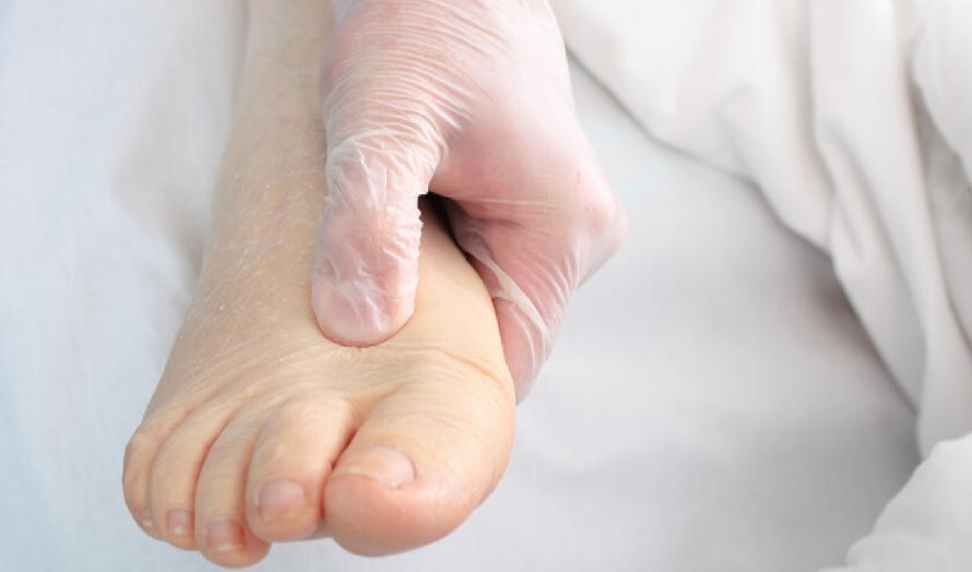 孕妇脚肿是因为营养不足吗,孕期脚肿与走路多少有关系吗