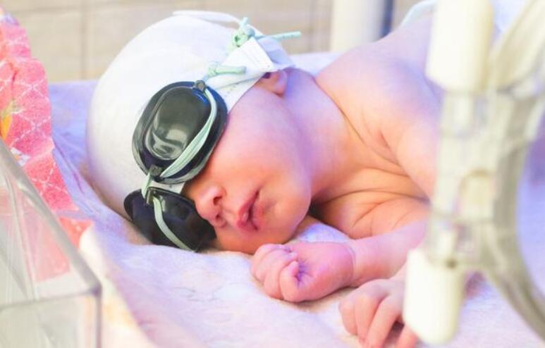 新生儿黄疸严重应该要注意些什么,新生儿黄疸如何去得快一招搞定