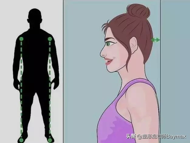 纠正颈部前伸最简单有效的方法,颈部前伸怎么办