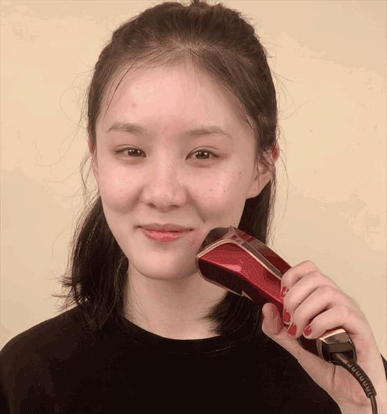 微整的真实效果,微整蜕变过程