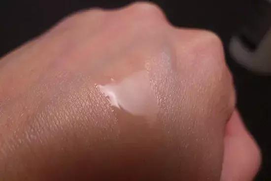 金银花对付痘痘,对付所有痘痘的药膏