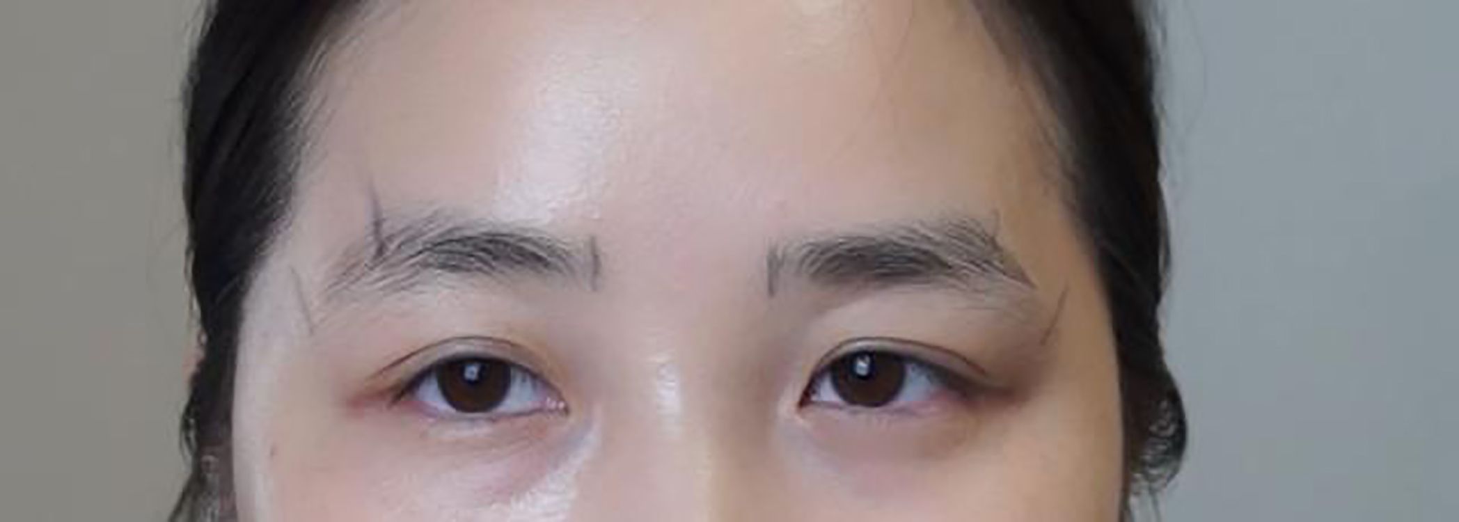 眉毛设计不对称的原因,眉毛不对称怎么办