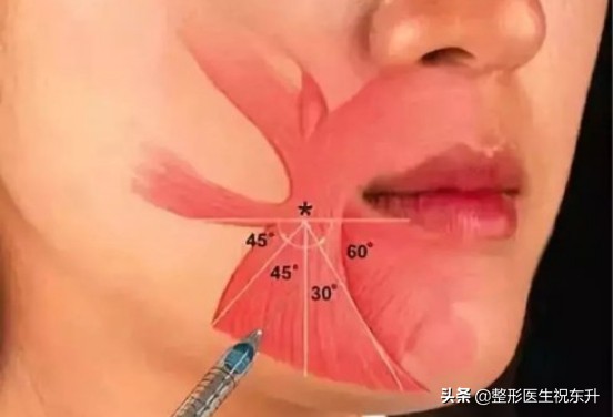 长期打肉毒素肌肉会萎缩么,注射肉毒素是不是康复治疗的方法