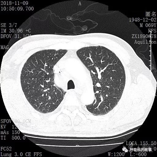 怎么应用统计学做调查,统计学方法可以解决的主要问题