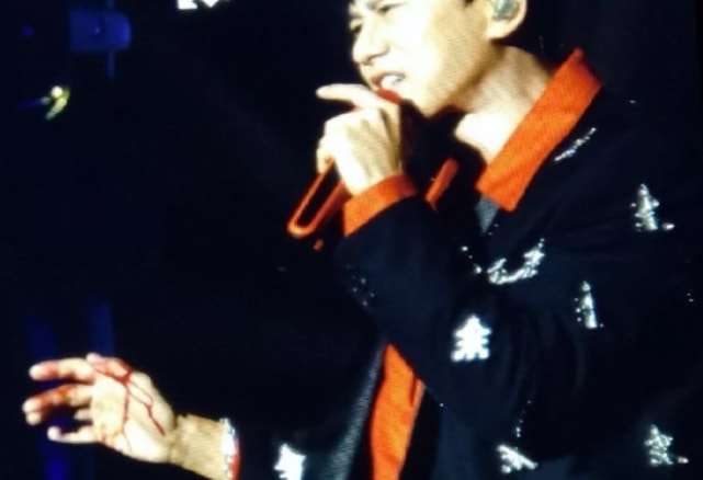 跳跳俏俏谢娜出席张杰演唱会,谢娜受伤张杰紧张的样子