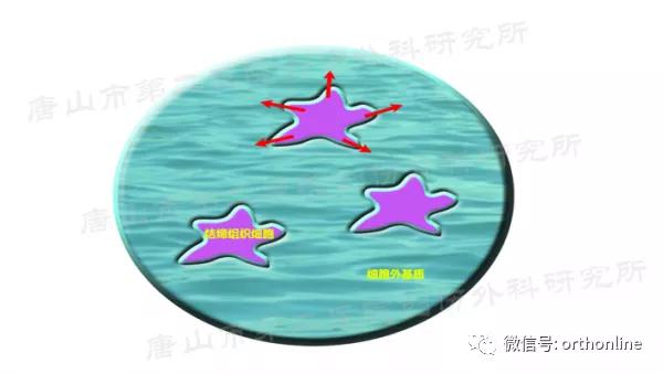 手部肌腱不完全断裂能完全复原吗,手部屈指肌腱损伤最难处理的部位