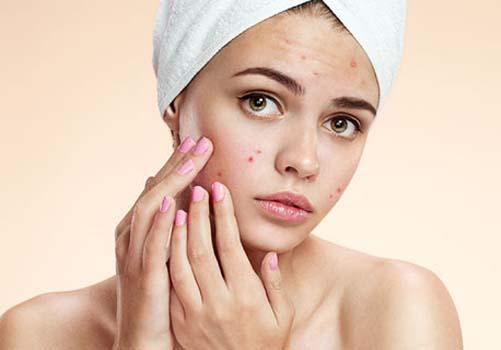 痘痘肌怎么护肤比较好,痘痘肌如何护肤学生