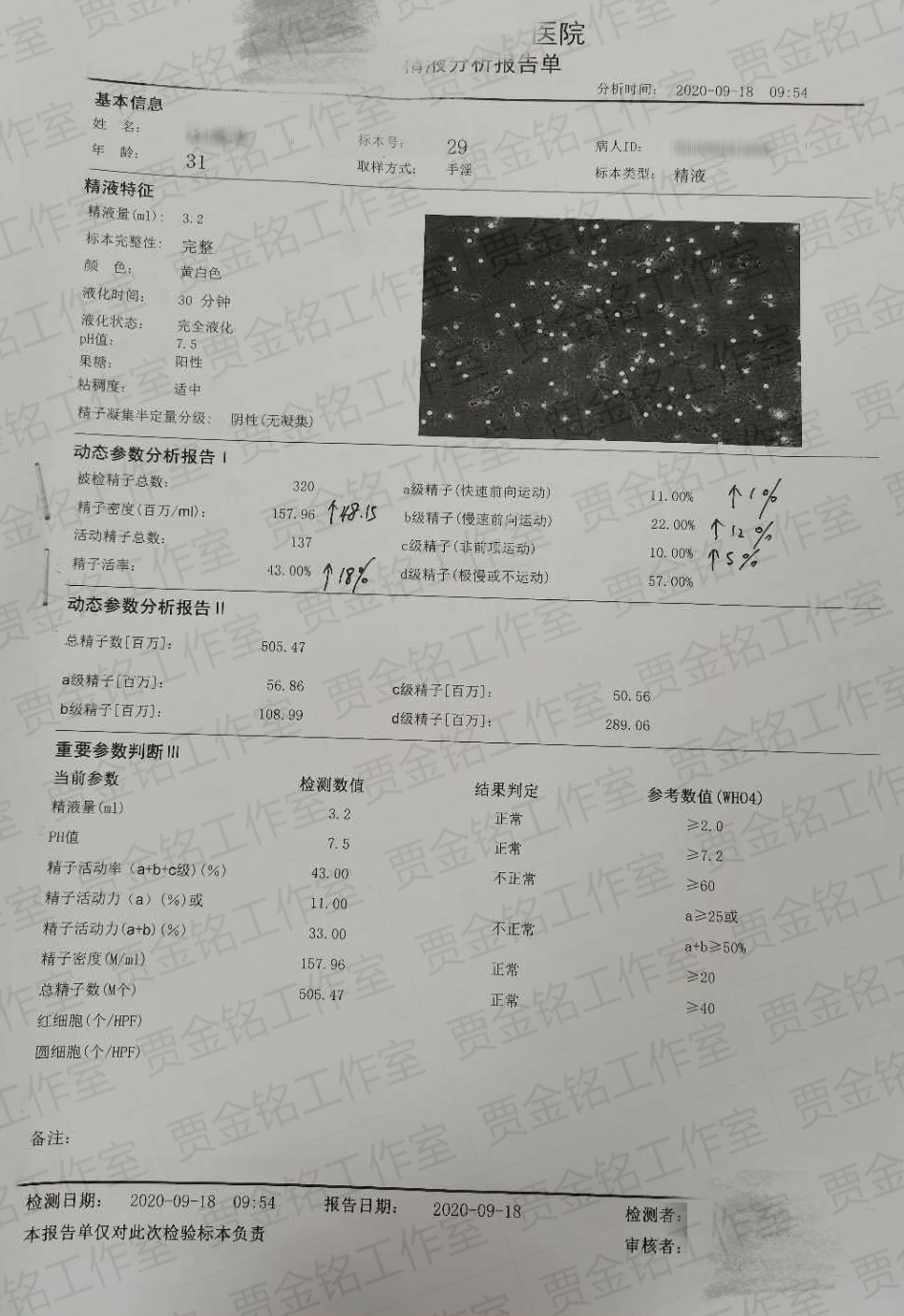 弱精子症患者备孕两个月的治疗精液检查，很开心回家可以要宝宝啦