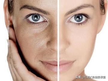 脸色发黄暗黑怎么消除,脸色晦暗怎么调理