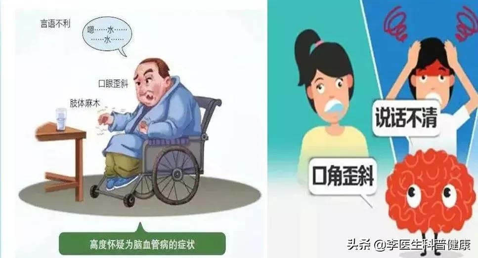 突然脑供血不足是什么原因,心脑血管供血不足的症状怎样治疗