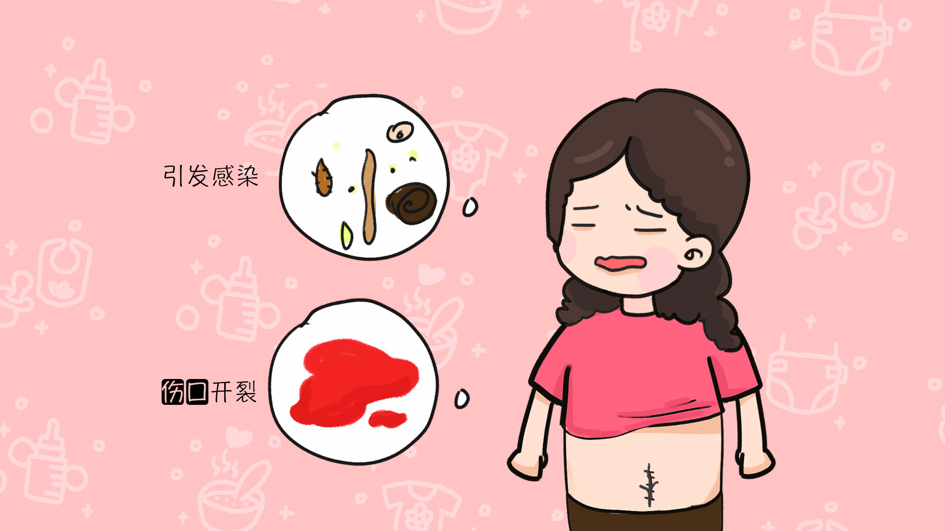 为什么剖腹产不用缝线了,为什么现在剖宫产不用拆线