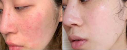 2019上黑名单的洗面奶前十,洗面奶黑名单