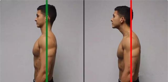 矫正颈部前伸最简单有效的方法,颈部前伸怎么矫正