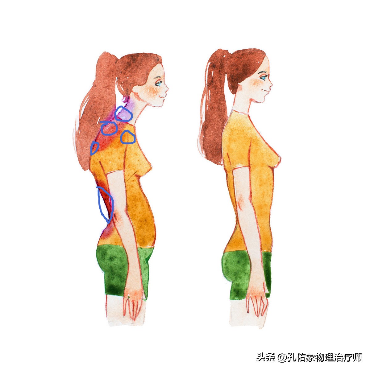 为什么颈肩部肌肉酸痛,肩颈疼痛严重解决最好办法