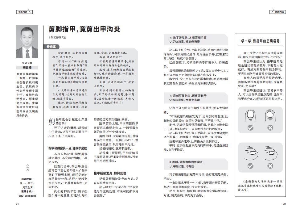 剪指甲会剪出甲沟炎吗,剪脚指甲的专用剪刀甲沟炎