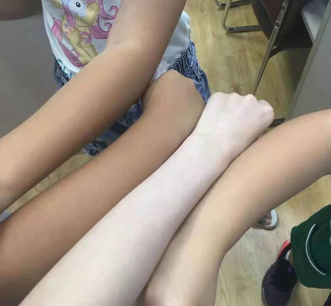 世界公认美白界的扛把子成分,美白三巨头成分