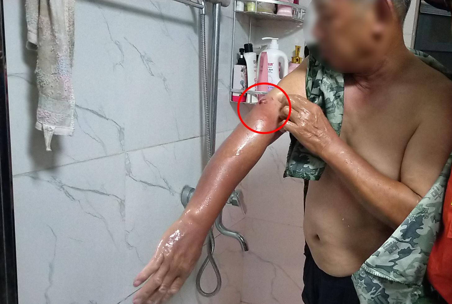 七旬老人手卡便池救人,老人手臂被卡便池消防助其脱困