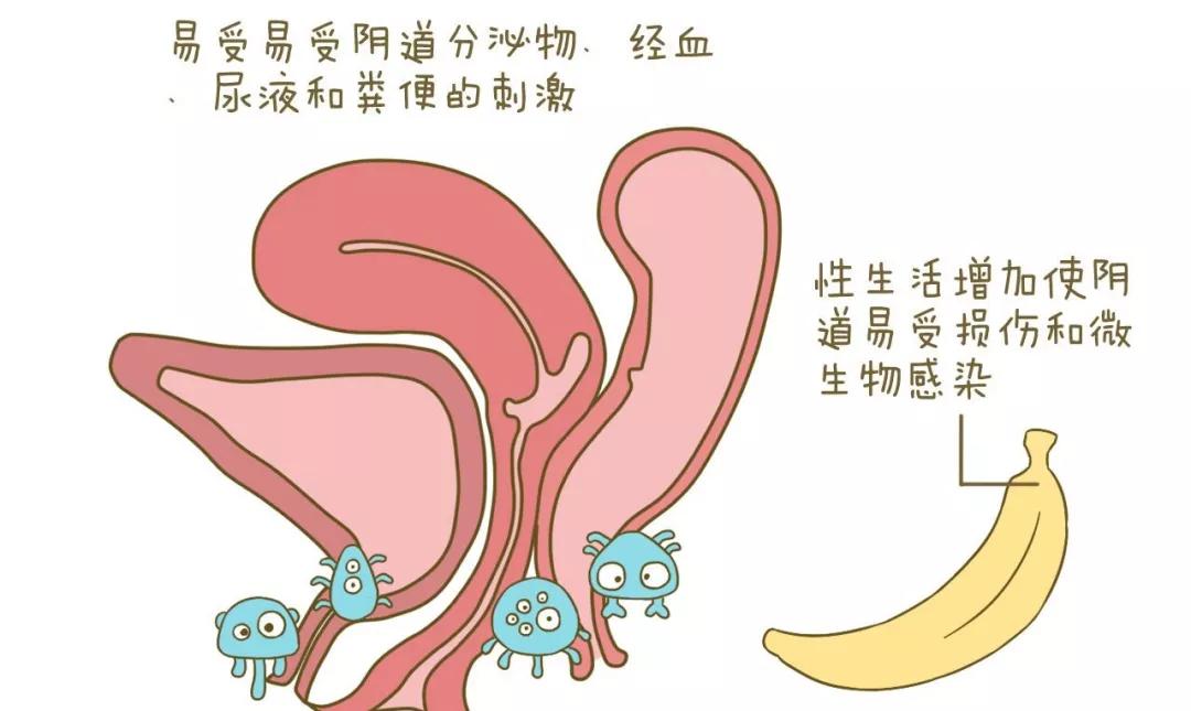 没有什么症状要做妇科检查吗,没有病症需要做妇科检查么