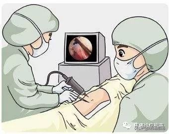 骨性关节炎诊疗指南,骨性关节炎诊疗指南欧美