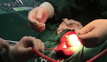 盐城协和医院靠谱吗,盐城协和医院医生介绍