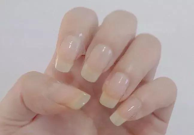 手指又粗又胖怎么办,手指短又粗怎么变长