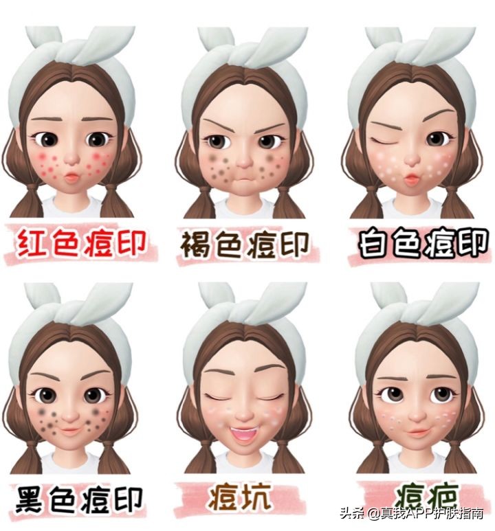 脸上红红的痘印怎么才能消除,怎么消除脸上的斑点和痘印喝什么