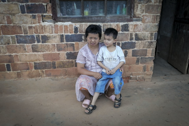 湖南8岁男孩体重仅40斤,小伙4岁失去双臂父亲精神失常