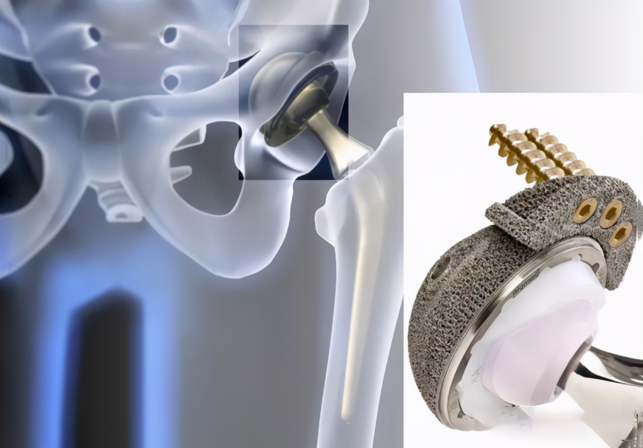 中国赶超美国的先进技术有哪些,赶超美国