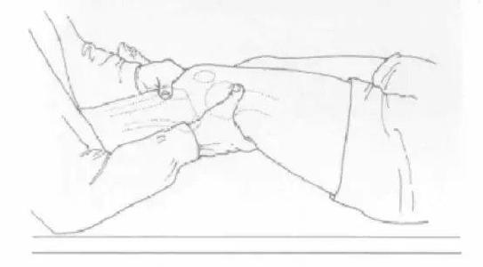 女排荣誉背后：郎平的髌骨被完全摘除！我们该怎么保护髌骨？