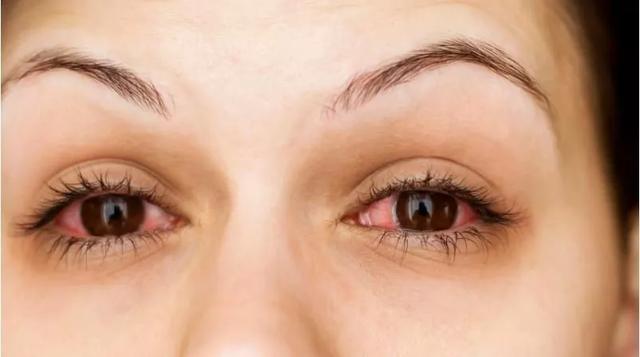 美国版睫毛增长液,法国进口的睫毛增长液真的有效吗