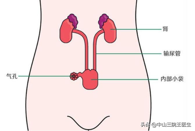 女性尿路感染九大症状吃什么药,关于尿路感染常见问题的最新解读