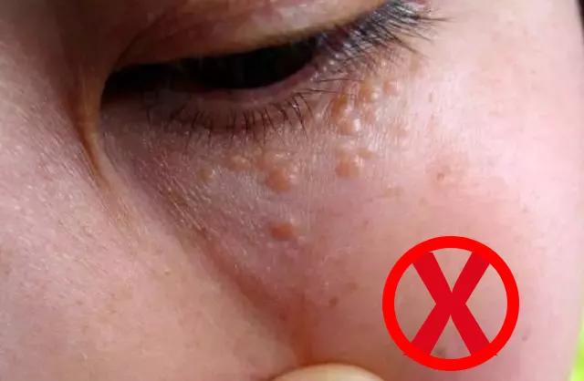 眼霜有必要用好一点的么,眼霜一般有没有用