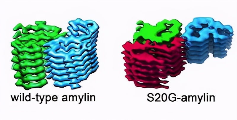 糖尿病干细胞研究进展,糖尿病医学研究进展