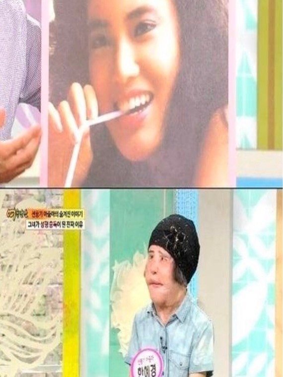 不用整形也可以变美吗,想变美做哪些手术