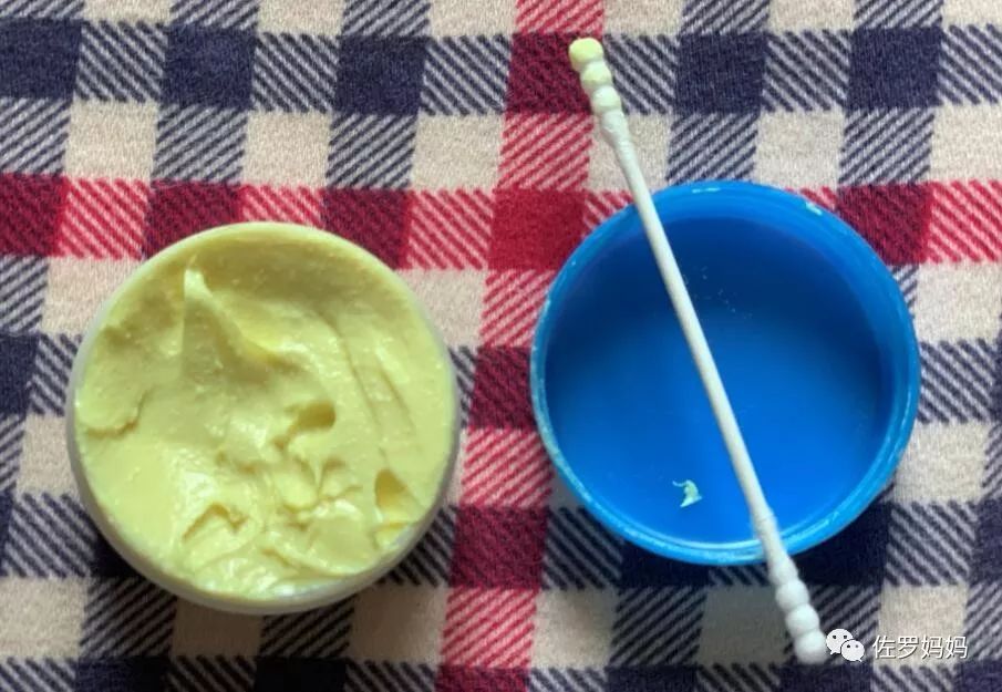 宝宝起疹子妈妈需要忌口吗,宝宝起湿疹妈妈着急