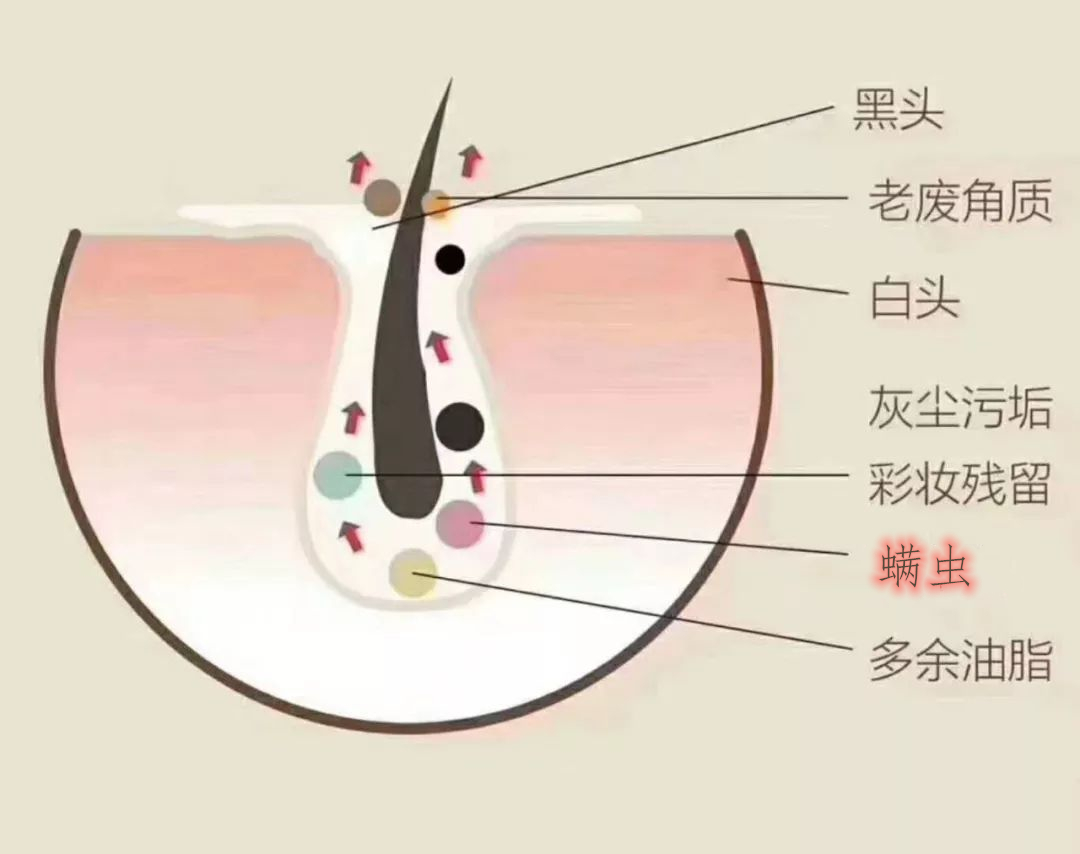 身上的螨虫会粘在衣服上吗,身上螨虫太多身体会烂么