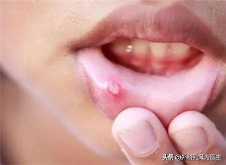 怎样判断得了丹毒,请问专家丹毒是怎么回事