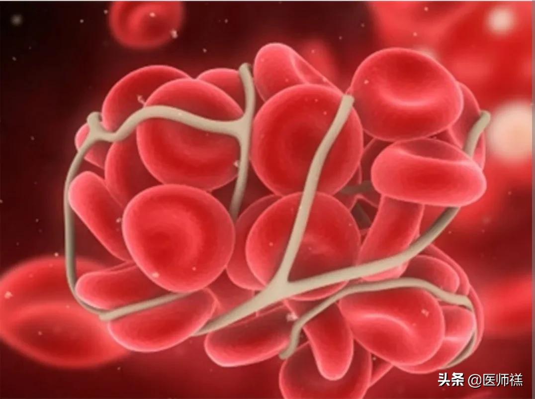 医生提醒阿托伐他汀的常见副作用,长期吃阿托伐他汀需要注意什么