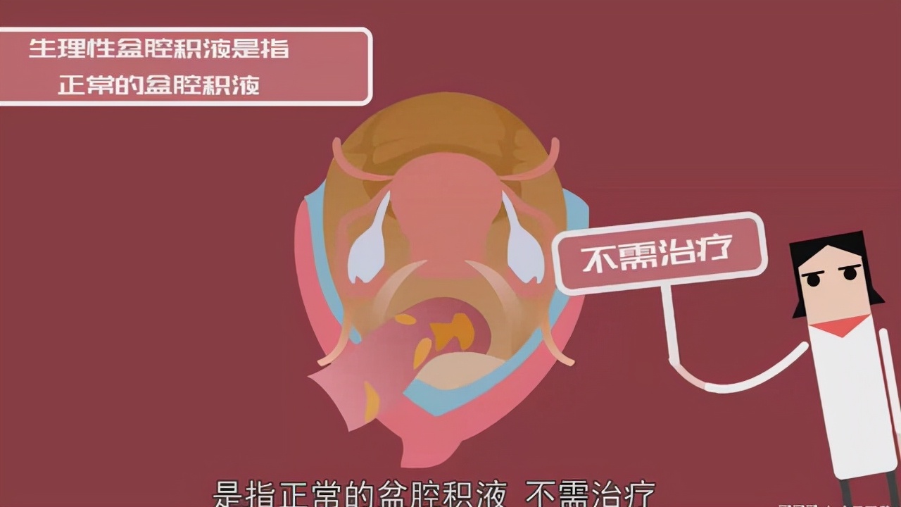 一般有妇科病都注意哪些,女性常见的哪些疾病不要治