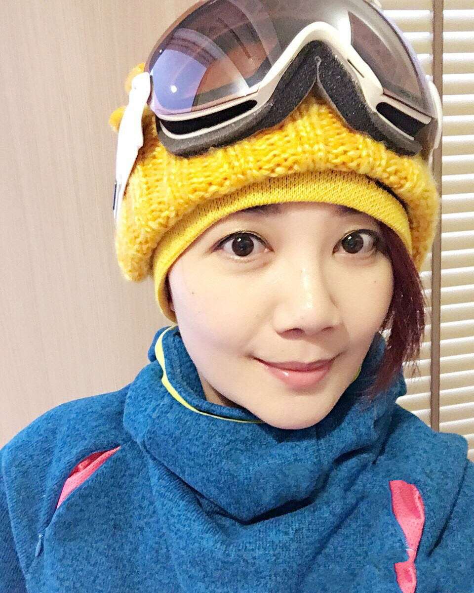 脸和眼下双八字纹的面相,女人脸有八字纹面相