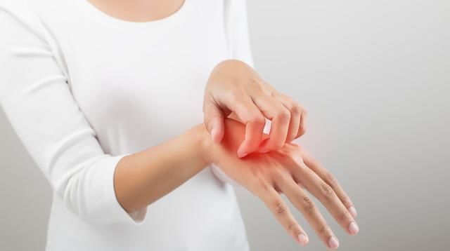 慢性顽固性皮肤湿疹荨麻疹治疗,湿疹荨麻疹神经性皮炎能根治吗