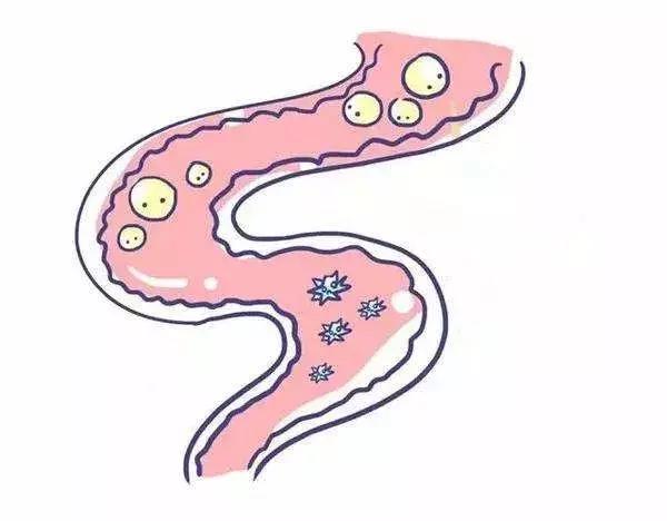 乳糖不耐受喝什么伊利舒化奶,乳糖不耐受的小孩适合哪款舒化奶