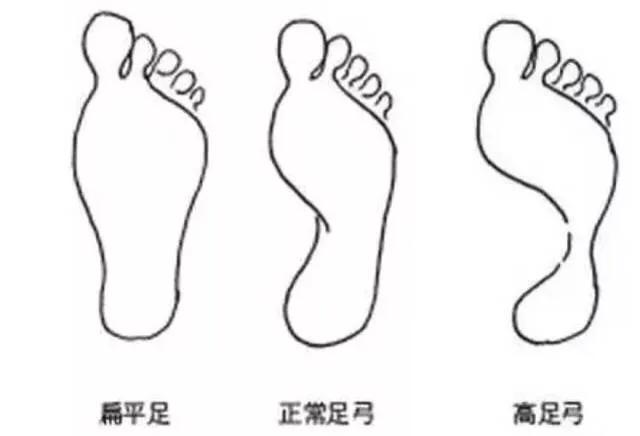 脚宽脚型不好看穿什么鞋,脚宽穿鞋子不好看学生